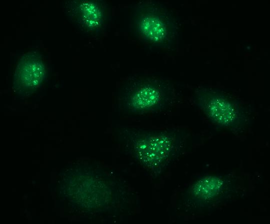 Dr. Hill's lab uses immunofluorescence microscopy to study the dynamics of different proteins throughout tumor cells.
